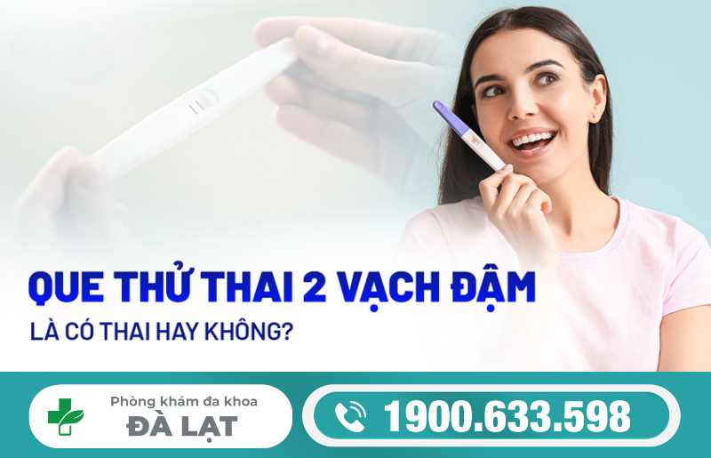 Hình ảnh minh họa